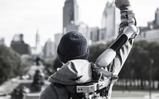 Titan Arm, James Dyson Award winner in 2013.